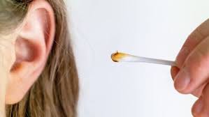 The Do S Don Ts Of Ear Wax Removal