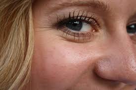 how to remove under eye wrinkles fast
