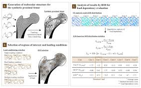 trabecular bone microstructure