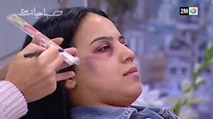 moroccan tv shows how to cover domestic violence bruises with makeup