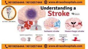 the best stroke and cerebrovascular