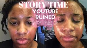 storytime you ruined my face