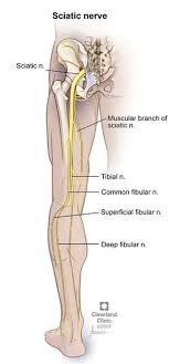 Sciatica Leg Pain Cleveland Clinic