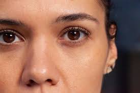 how to remove under eye dark circles