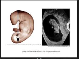 Daroga Early Pregnancy How To Calculate The Expected Day Of Delivery Edd Or Confinement Edc