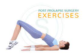 exercises after prolapse surgery smiles