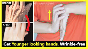 wrinkled hands causes treatment and