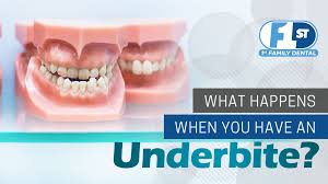 How to fix underbite in children? What Happens When You Have An Underbite 1st Family Dental Blog