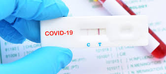 rapid covid 19 test available all