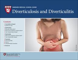 Diverticulosis And Diverticulitis Harvard Health
