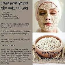 remes to remove acne scars nykaa