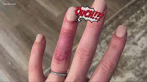 infection after nail salon visit it s