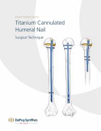 anium cannulated humeral nailsynthes