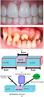 investigation on enamel and dentine of