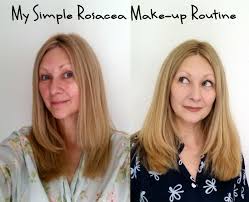 my simple rosacea make up routine