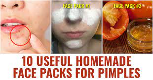 homemade face packs for pimples
