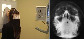 Radiographic Positioning Radiology Key