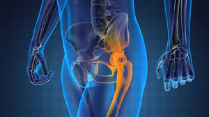 prostate cancer with bone metastases