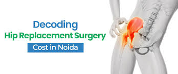 decoding hip replacement surgery cost