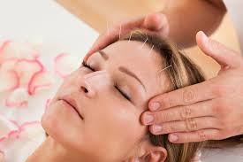 Cosmetic Acupuncture Nyc Facial Rejuvenation Acupuncture