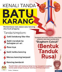 1.10 sketsa buah buahan (jeruk). Kementerian Kesihatan Malaysia Batu Karang Menyebabkan Sakit Belakang Yang Teruk Yang Digambarkan Lebih Teruk Dari Sakit Waktu Bersalin Batu Karang Boleh Terbentuk Pada Buah Pinggang Nephrolithiasis Atau Di Salur Ureter Di