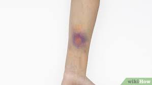 how to make a fake bruise with makeup