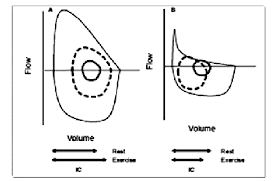 maximum and tidal flow volume curves