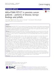 Pdf 68ga Psma Pet Ct In Prostate Cancer Patients Patterns