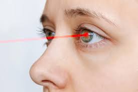 laser vision correction closeup