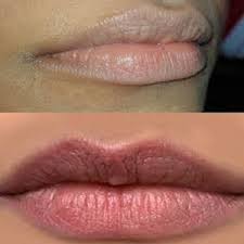semi permanent lip color treatment in