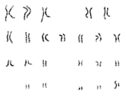 Image result for wikipedia autosomal DNA inheritance image