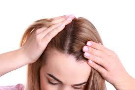 s that cause hair loss in women too