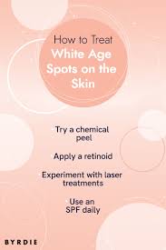 white spots on your skin