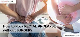 rectal prolapse without surgery