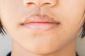 chapped lips tips చల క ప దవ ల