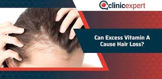 can excess vitamin a cause hair loss