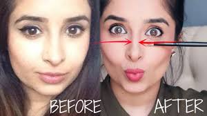 thinner nose without plastic surgery