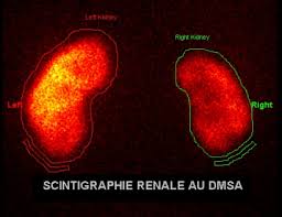 La scintigraphie est une technique d'imagerie médicale réalisée uniquement dans les services de médecine nucléaire. Specialites Centre De Medecine Nucleaire Et Tep Paris Nord Seny