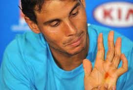 This means that my skin can start to split on. Rafael Nadal It S Hard To Play With This Bondage On The Hand