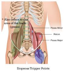 acupuncture for psoas trigger points