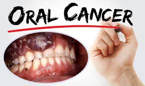 the causes and symptoms of cancer