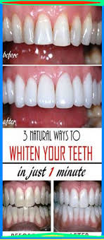 Whitening toothpastes work the same way with more ingredients; Pin On Home Remedies