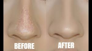 nose oily skin tricks