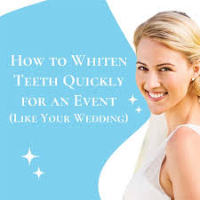 how to whiten teeth quickly for an