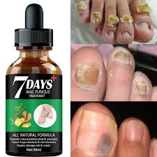 nail fungus treatment hand foot care