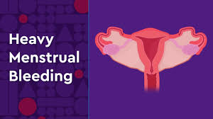 abnormal menstrual bleeding children