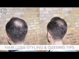 balding or thinning hair