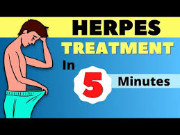 herpes treatment herpes