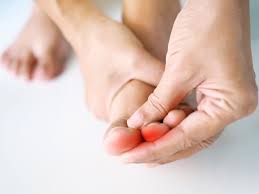 ingrown toenail signs symptoms and
