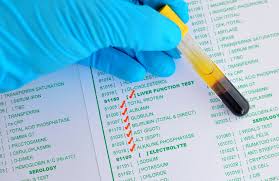 Liver Function Tests Aidsmap